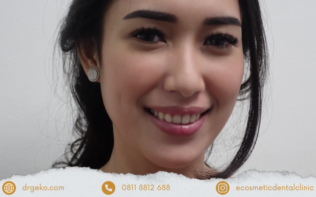 Gigi Putih dan Rata: Tren yang Berkembang Menjadi Budaya